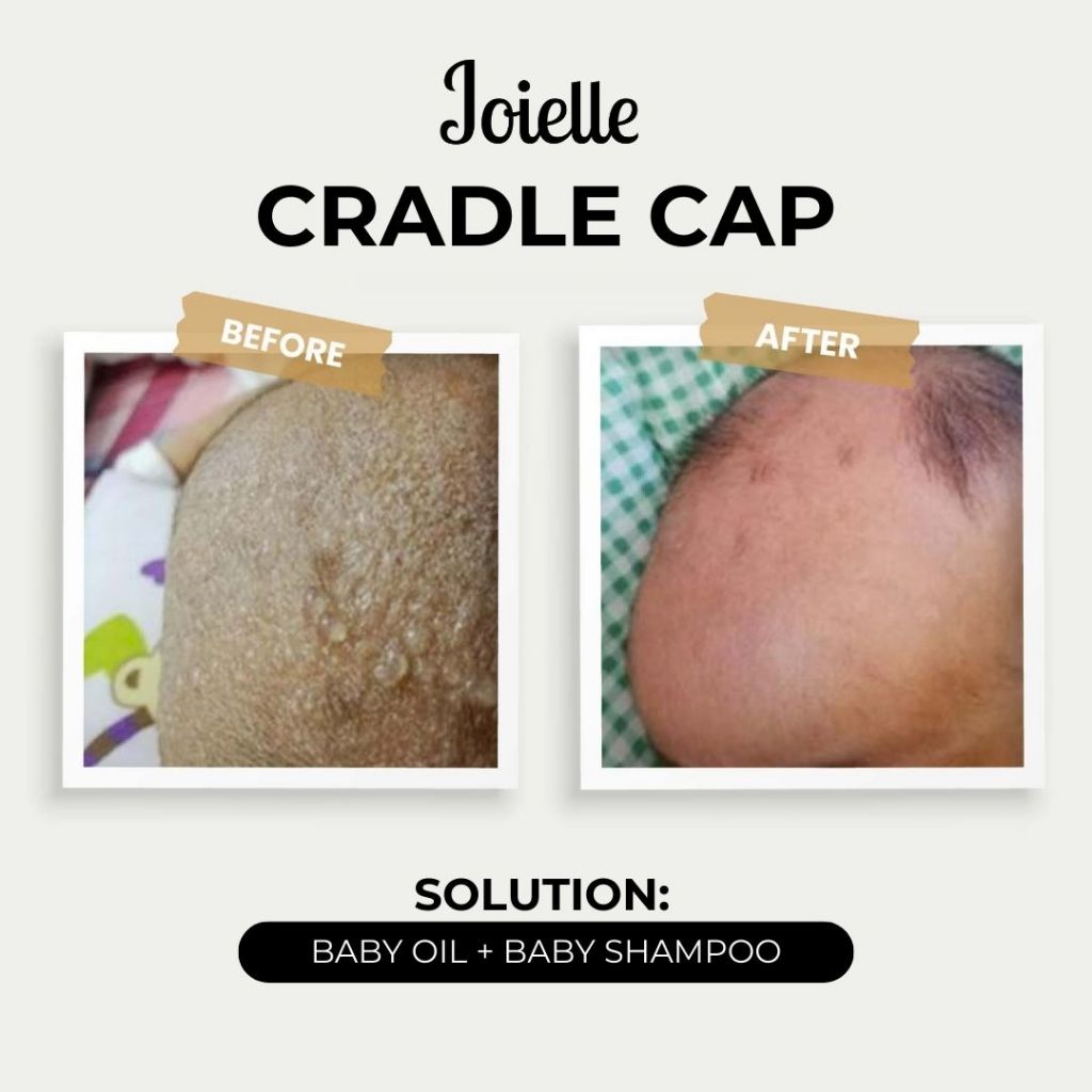 Limited Edition Petite Sample Joielle Baby