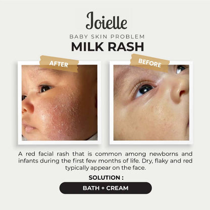 Combo Baby Bath + Baby Cream (Normal To Sensitive Skin)